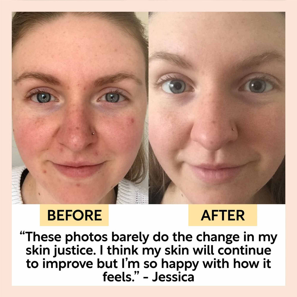 Before and after comparison of a person's face with positive testimonial text