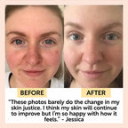 Before and after comparison of a person's face with positive testimonial text