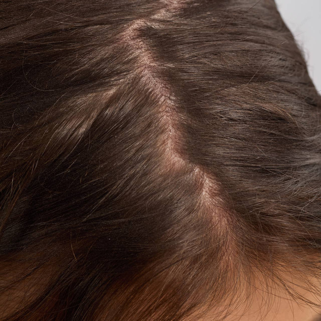Close-up of a person's scalp and parting, with healthy, shiny dark brown hair.